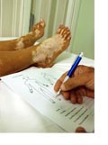 Programa para el tratamiento del Vitiligo, la Psoriasis y la Alopecia